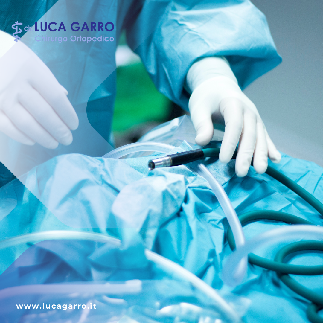 Il Trattamento Dell’Anca Con Artroscopia: Una Soluzione Moderna E Minimamente Invasiva