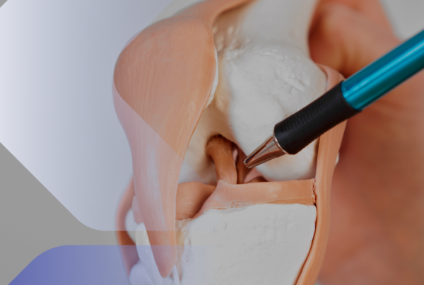 Rottura Legamenti Ginocchio